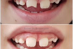 01-caso-clinica-dental-esther-de-bustamante