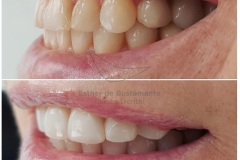 10-caso-clinica-dental-esther-de-bustamante