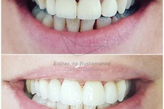 14-caso-clinica-dental-esther-de-bustamante