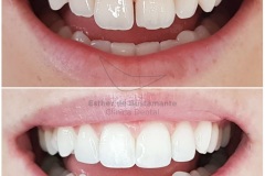 19-caso-clinica-dental-esther-de-bustamante