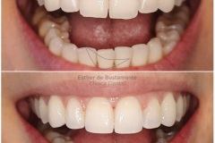 20-caso-clinica-dental-esther-de-bustamante