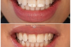 21-caso-clinica-dental-esther-de-bustamante