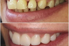 25-caso-clinica-dental-esther-de-bustamante