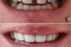 29-caso-clinica-dental-esther-de-bustamante