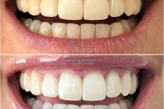 30-caso-clinica-dental-esther-de-bustamante