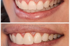 31-caso-clinica-dental-esther-de-bustamante