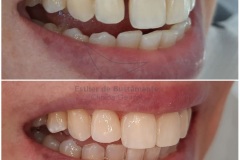 32-caso-clinica-dental-esther-de-bustamante