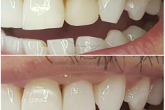 35-caso-clinica-dental-esther-de-bustamante