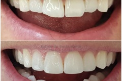 37-caso-clinica-dental-esther-de-bustamante