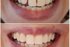 38-caso-clinica-dental-esther-de-bustamante