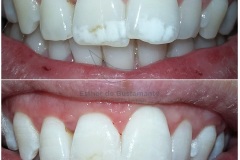 44-caso-clinica-dental-esther-de-bustamante