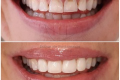 46-caso-clinica-dental-esther-de-bustamante