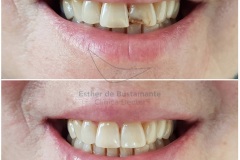 49-caso-clinica-dental-esther-de-bustamante