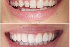 51-caso-clinica-dental-esther-de-bustamante