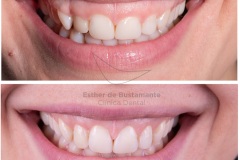 52-caso-clinica-dental-esther-de-bustamante