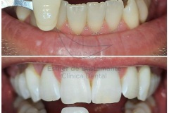 60-caso-clinica-dental-esther-de-bustamante