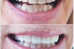 64-caso-clinica-dental-esther-de-bustamante