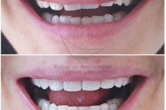 65-caso-clinica-dental-esther-de-bustamante
