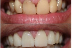 70-caso-clinica-dental-esther-de-bustamante