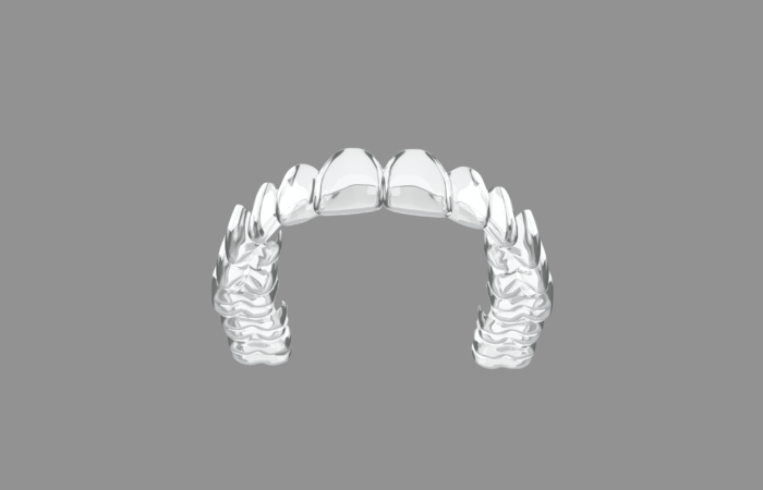 Invisalign