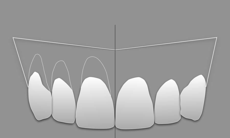 Cirugía plástica periodontal