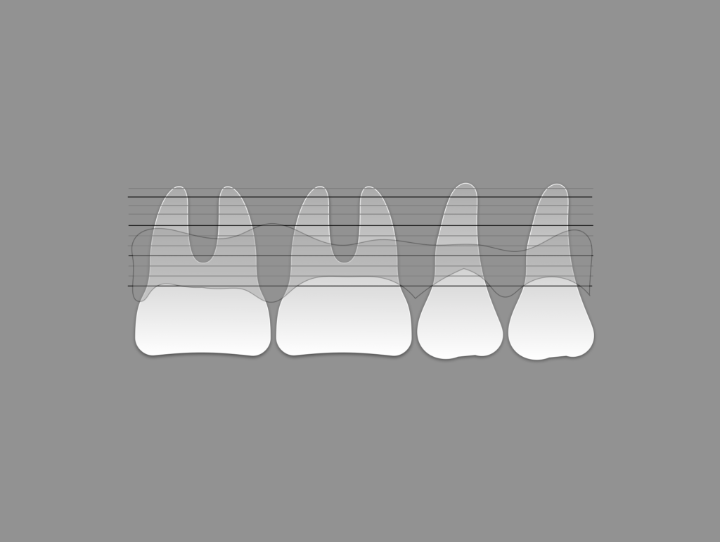 Periodoncia