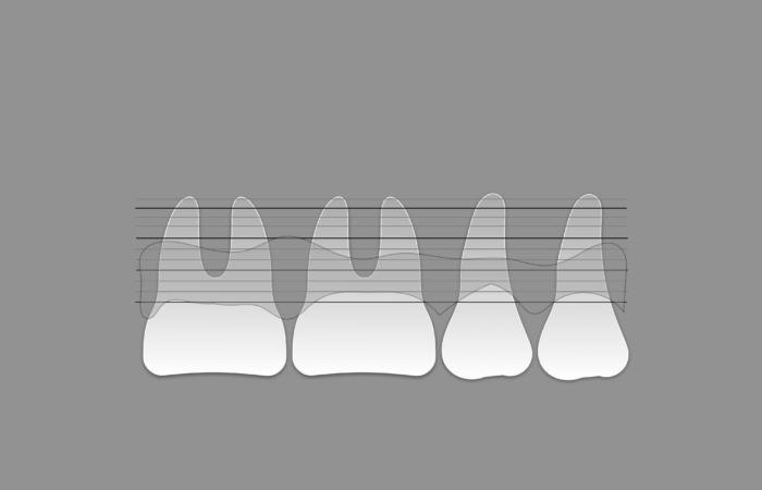 Periodoncia