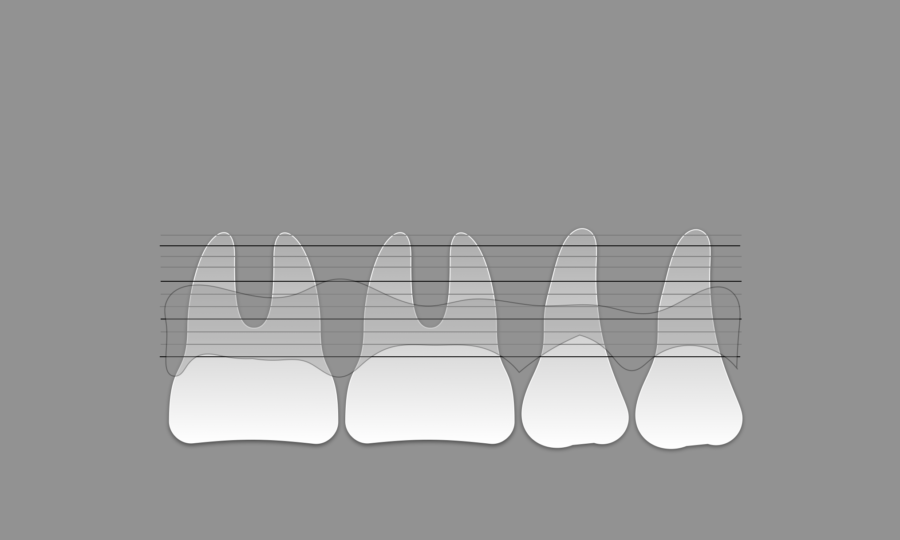 Periodoncia